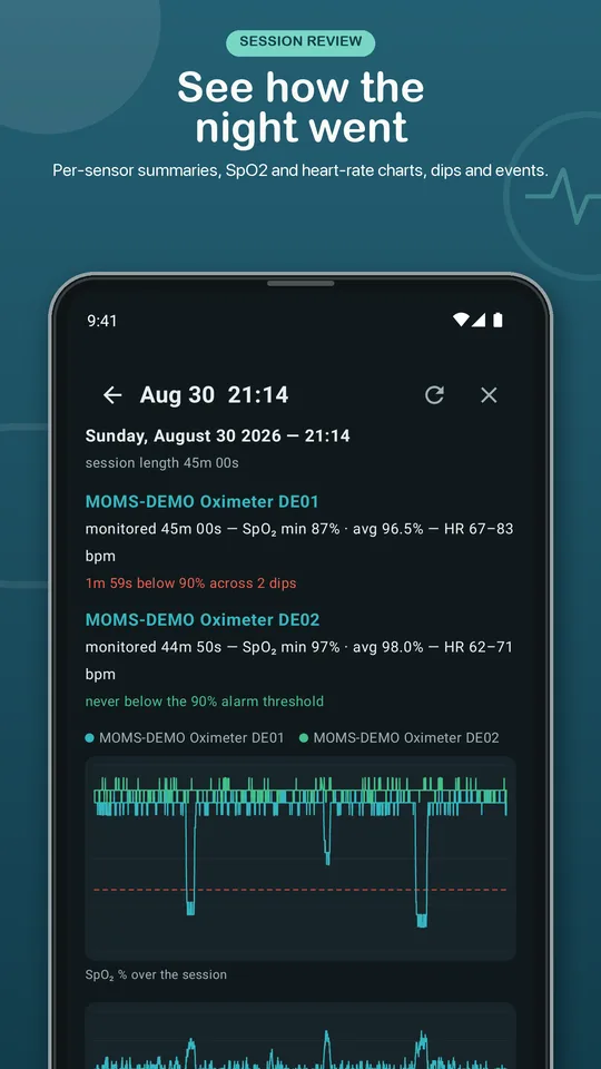 MOMS store preview showing session review charts with dips against the alarm threshold